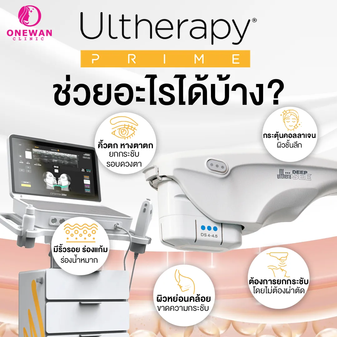 Ulthera Prime ช่วยอะไรได้บ้าง