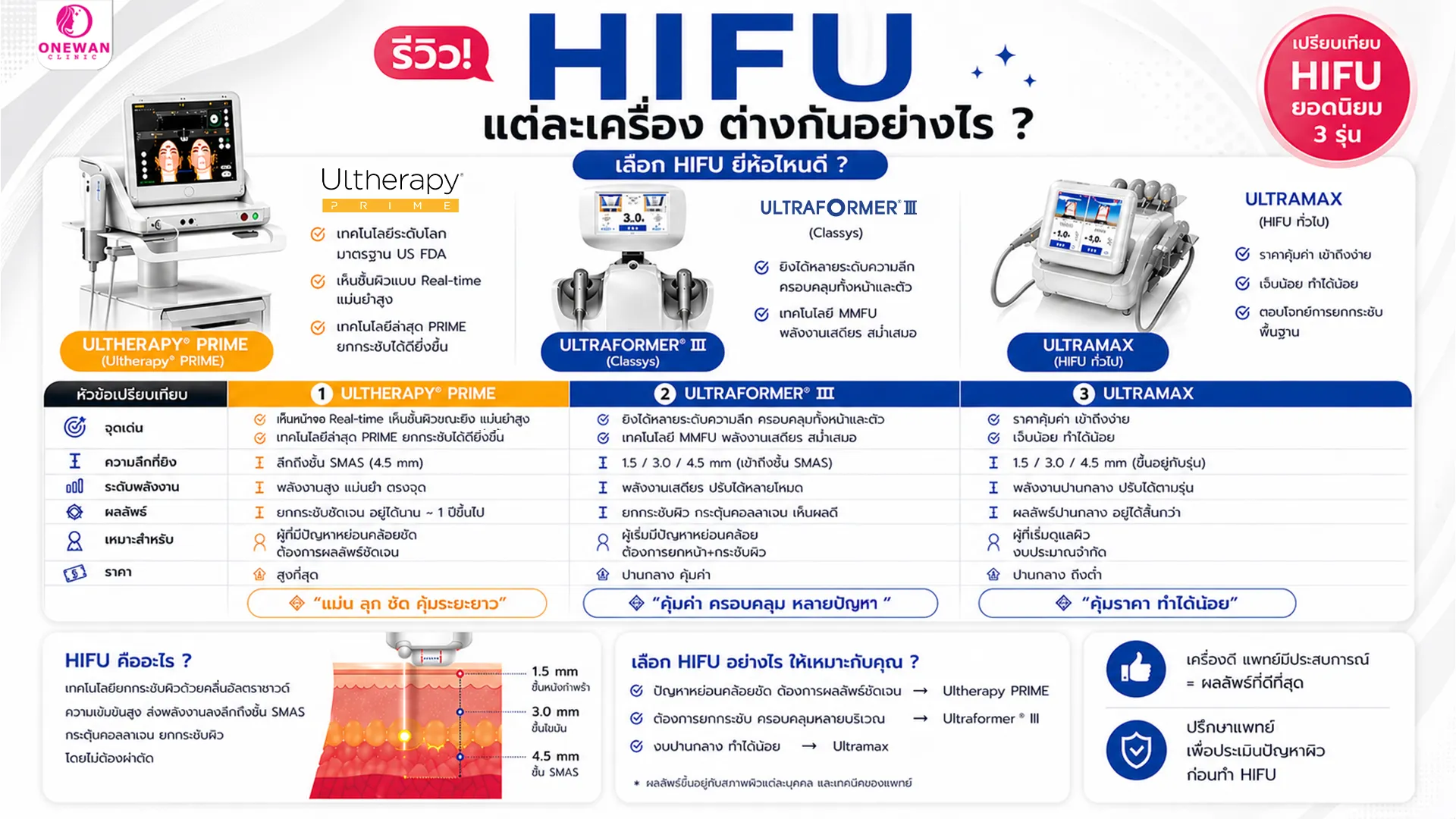 Hifu แต่ละเครื่อง ต่างกันอย่างไร