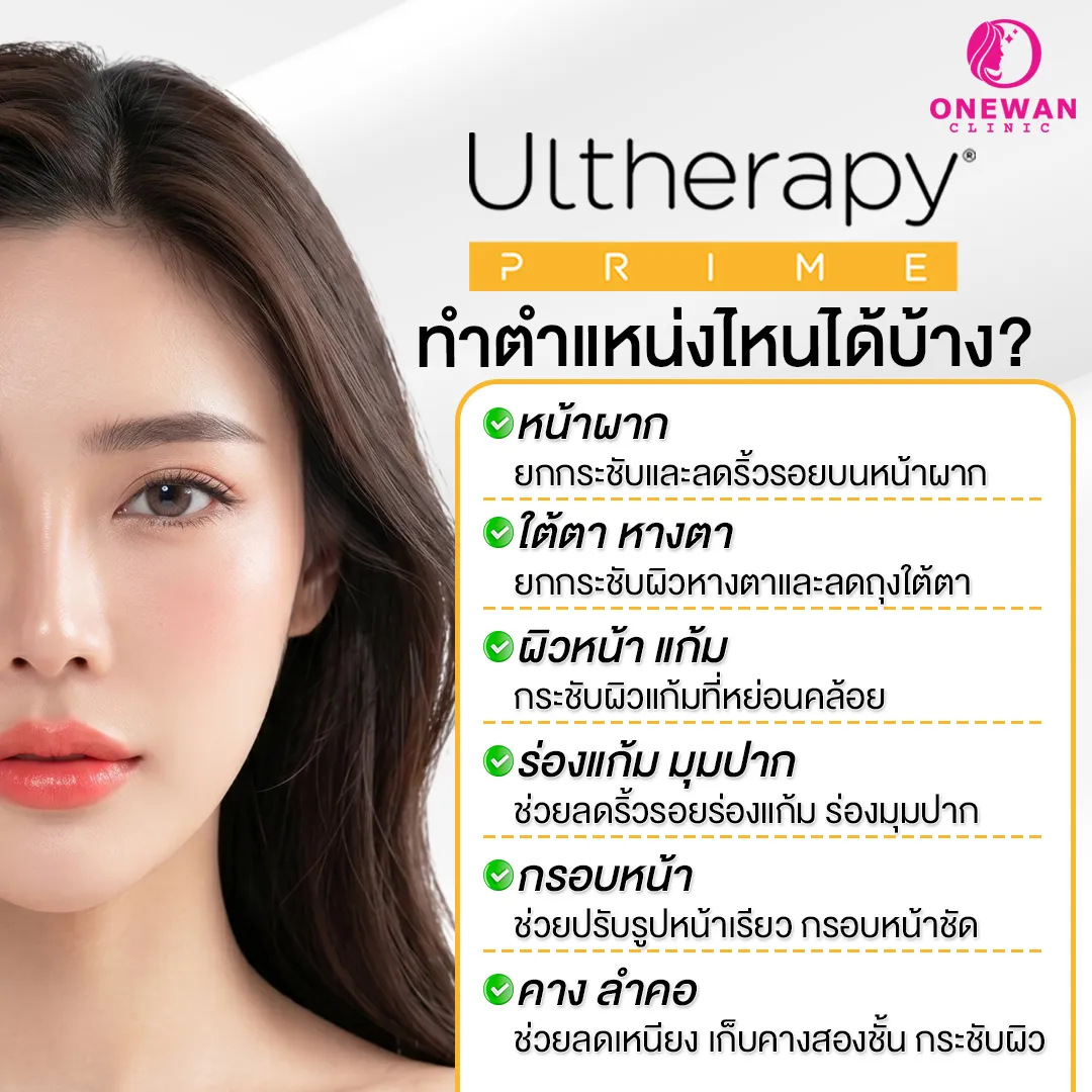 Ulthera Prime ทำตำแหน่งไหนได้บ้าง ?