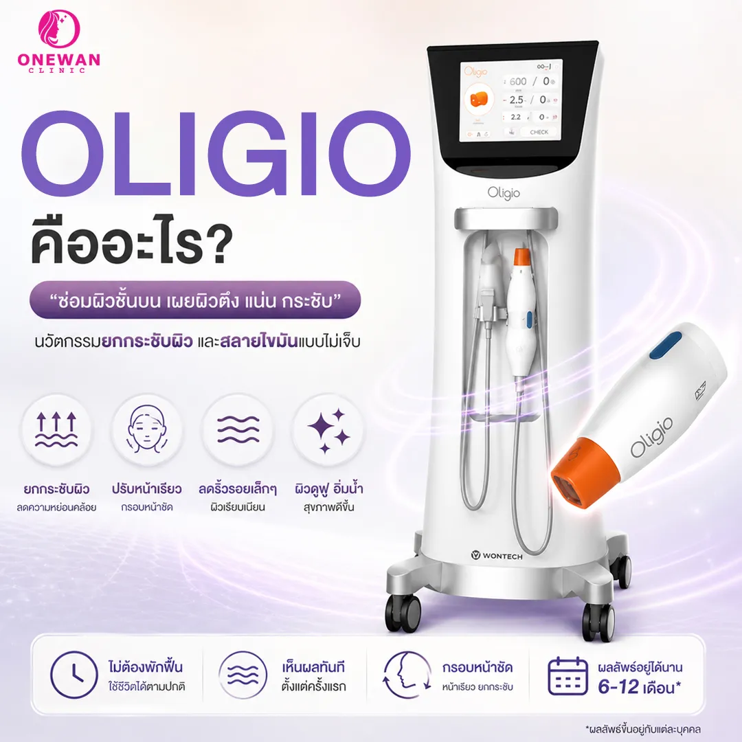 Oligio คืออะไร