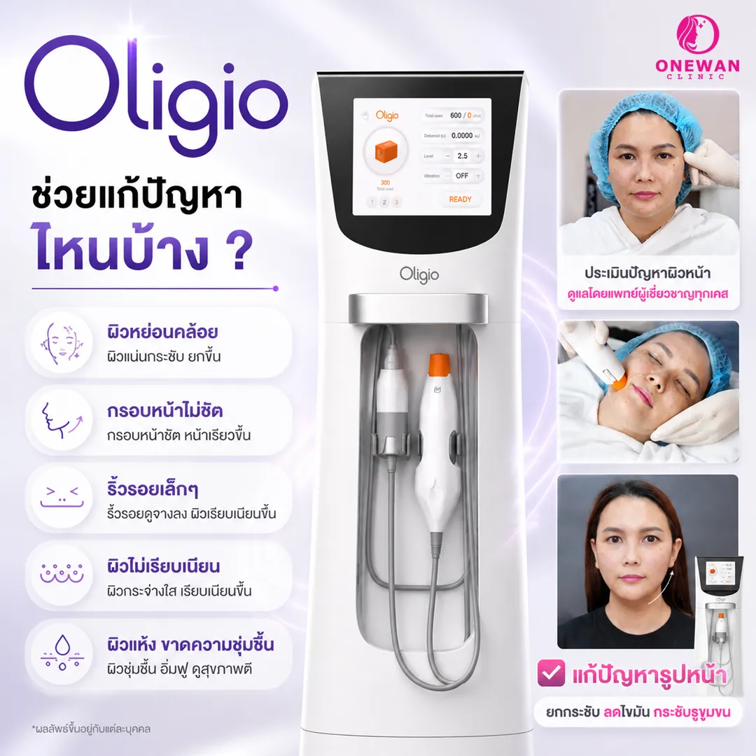 Oligio ช่วยแก้ปัญหาไหนบ้าง