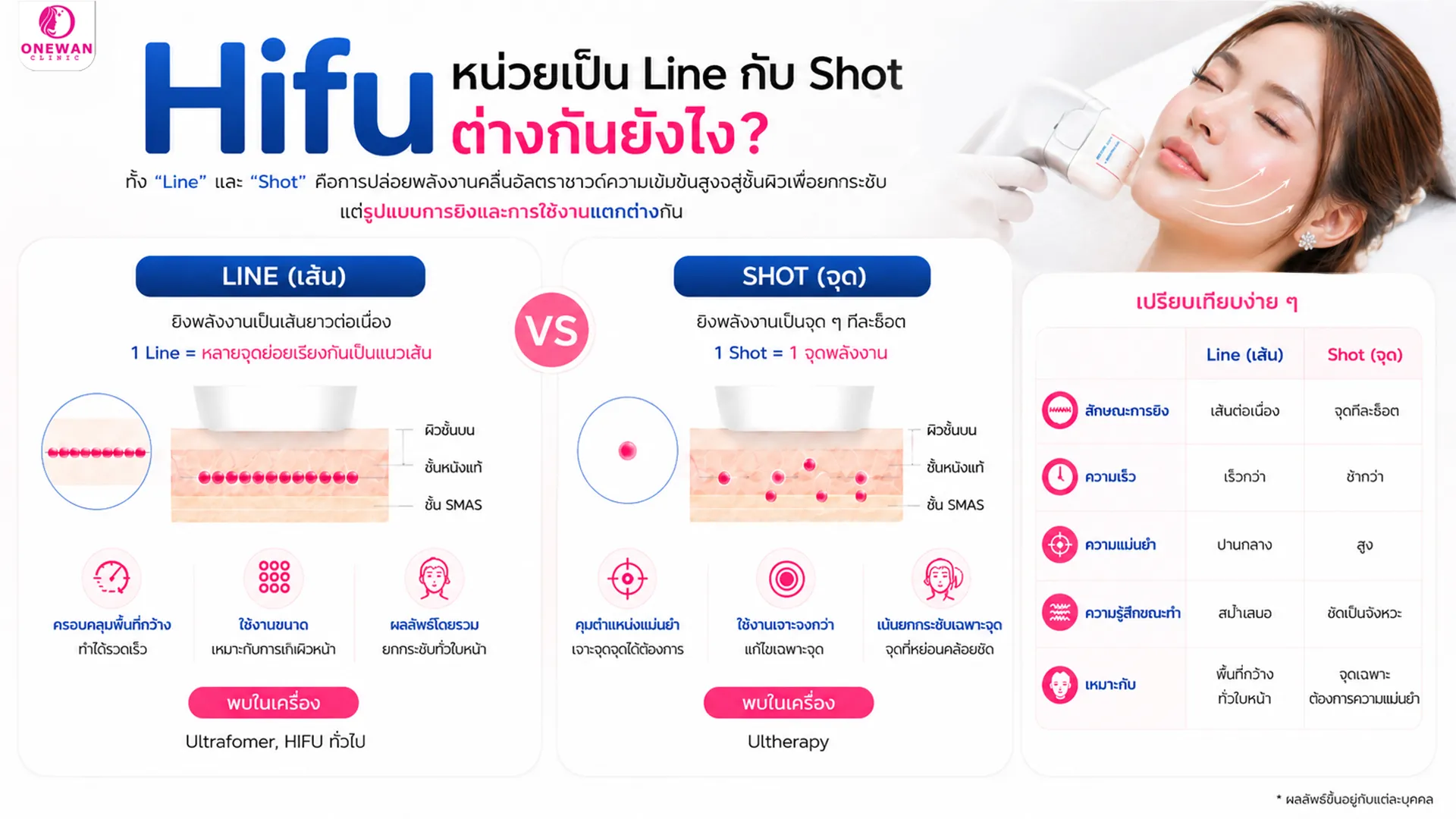 Hifu หน่วยเป็น Line กับ Shot ต่างกันยังไง