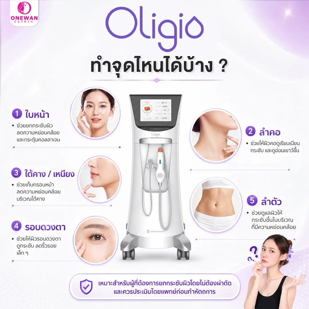 ทำ Oligio จุดไหนได้บ้าง