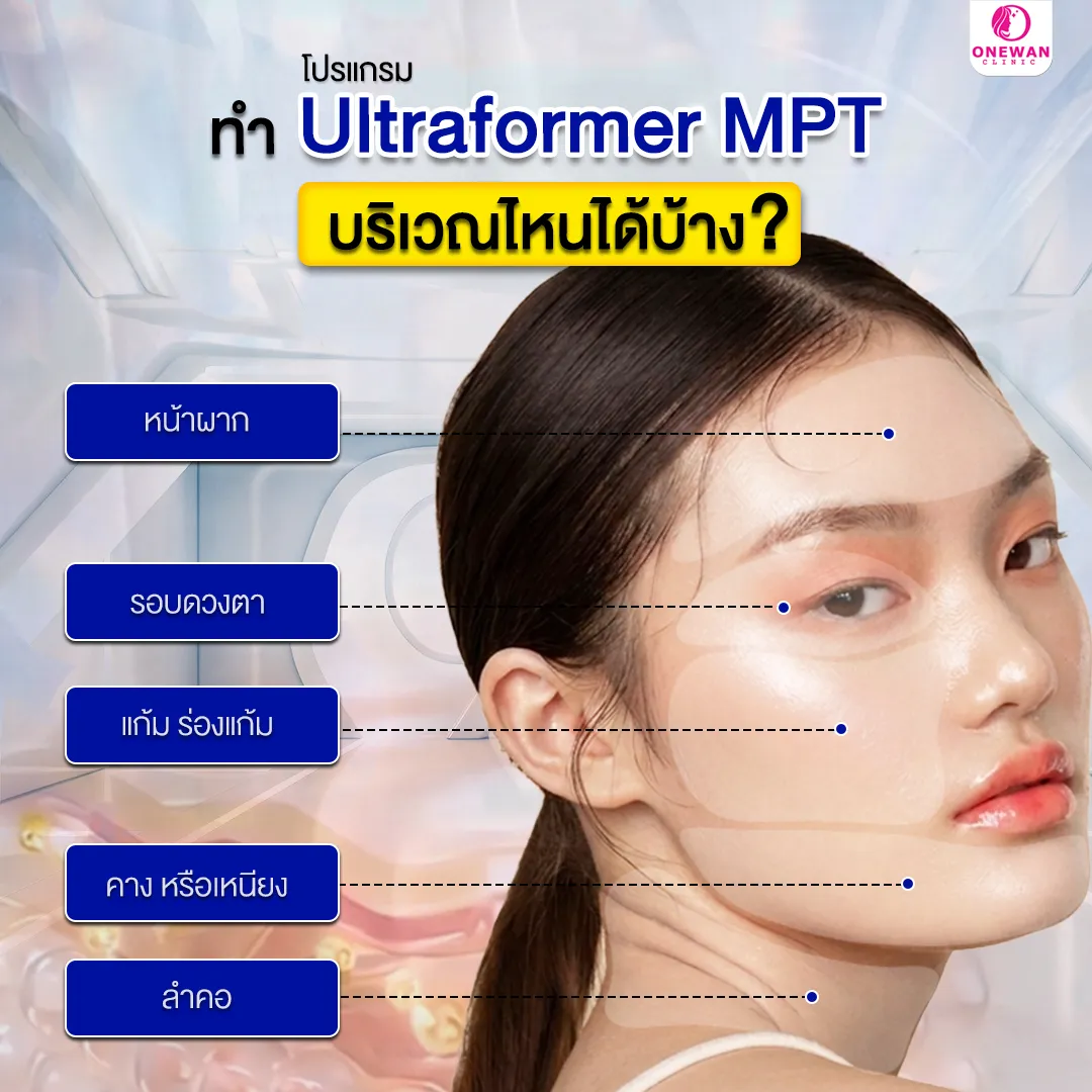 ทำ Ultraformer MPT บริเวณไหนได้บ้าง