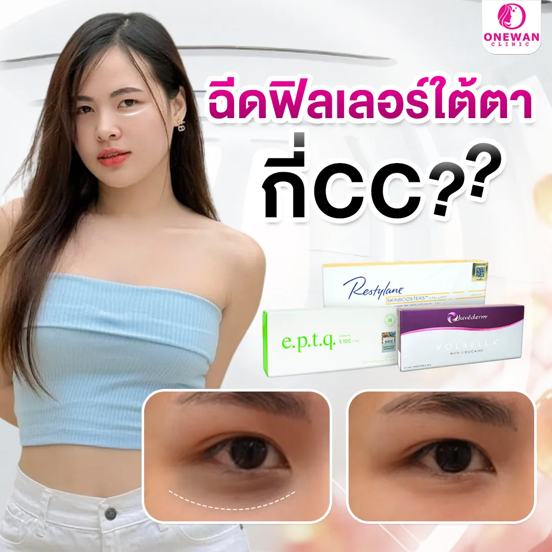 ฉีดฟิลเลอร์ใต้ตากี่ซีซี