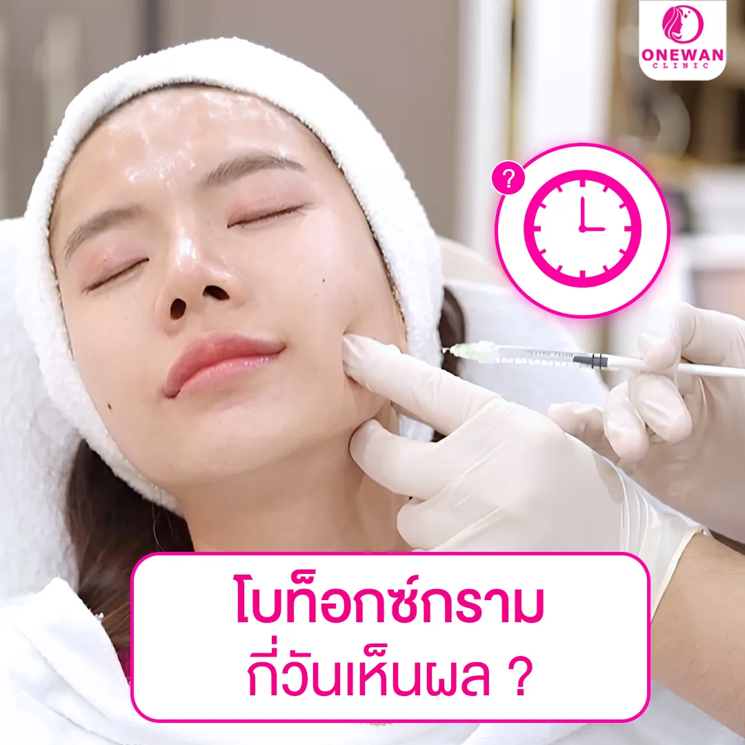 ฉีดโบท็อกกราม กี่วันเห็นผล