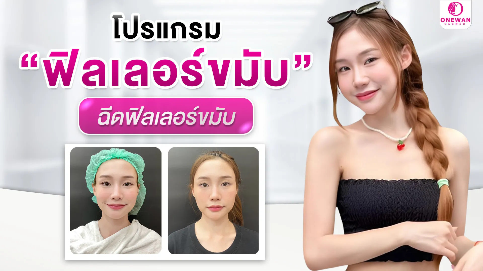 ฟิลเลอร์ขมับ บุรีรัมย์