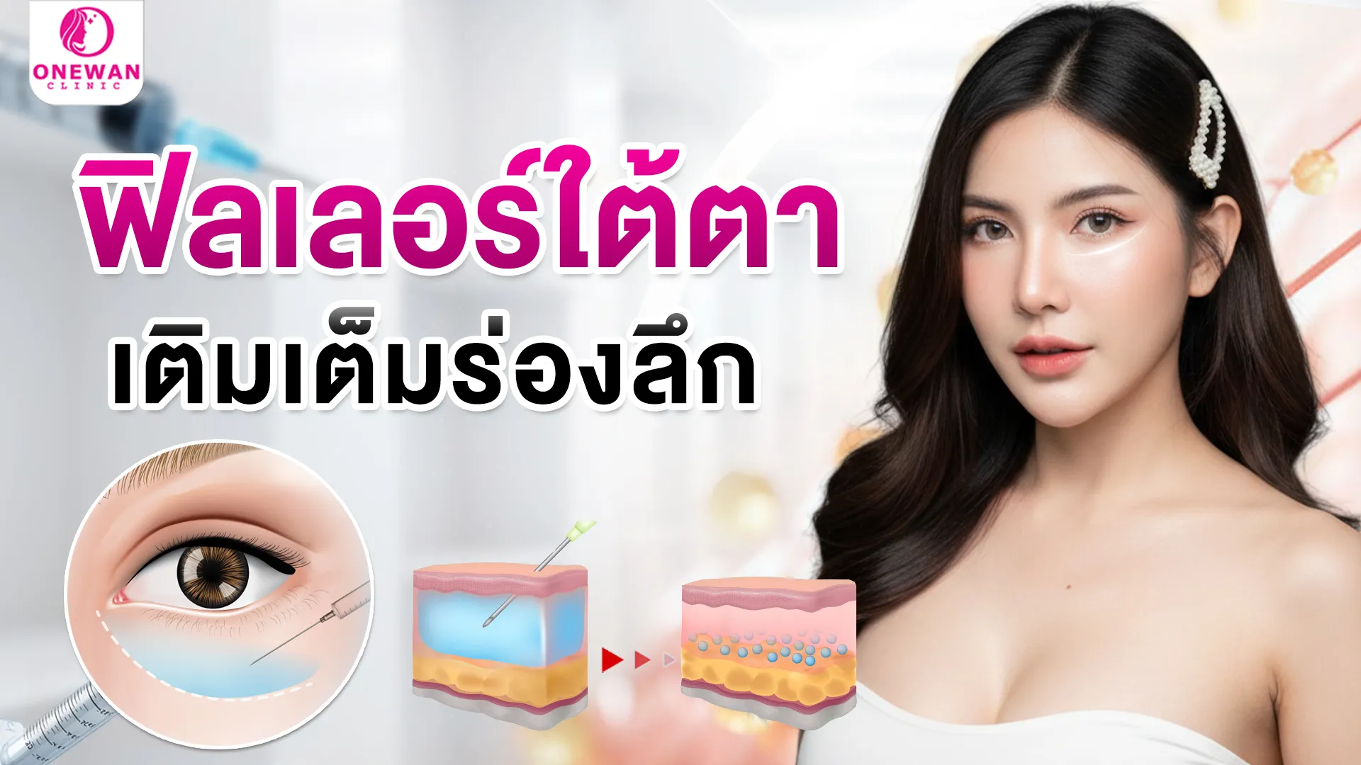 ฟิลเลอร์ใต้ตา บุรีรัมย์