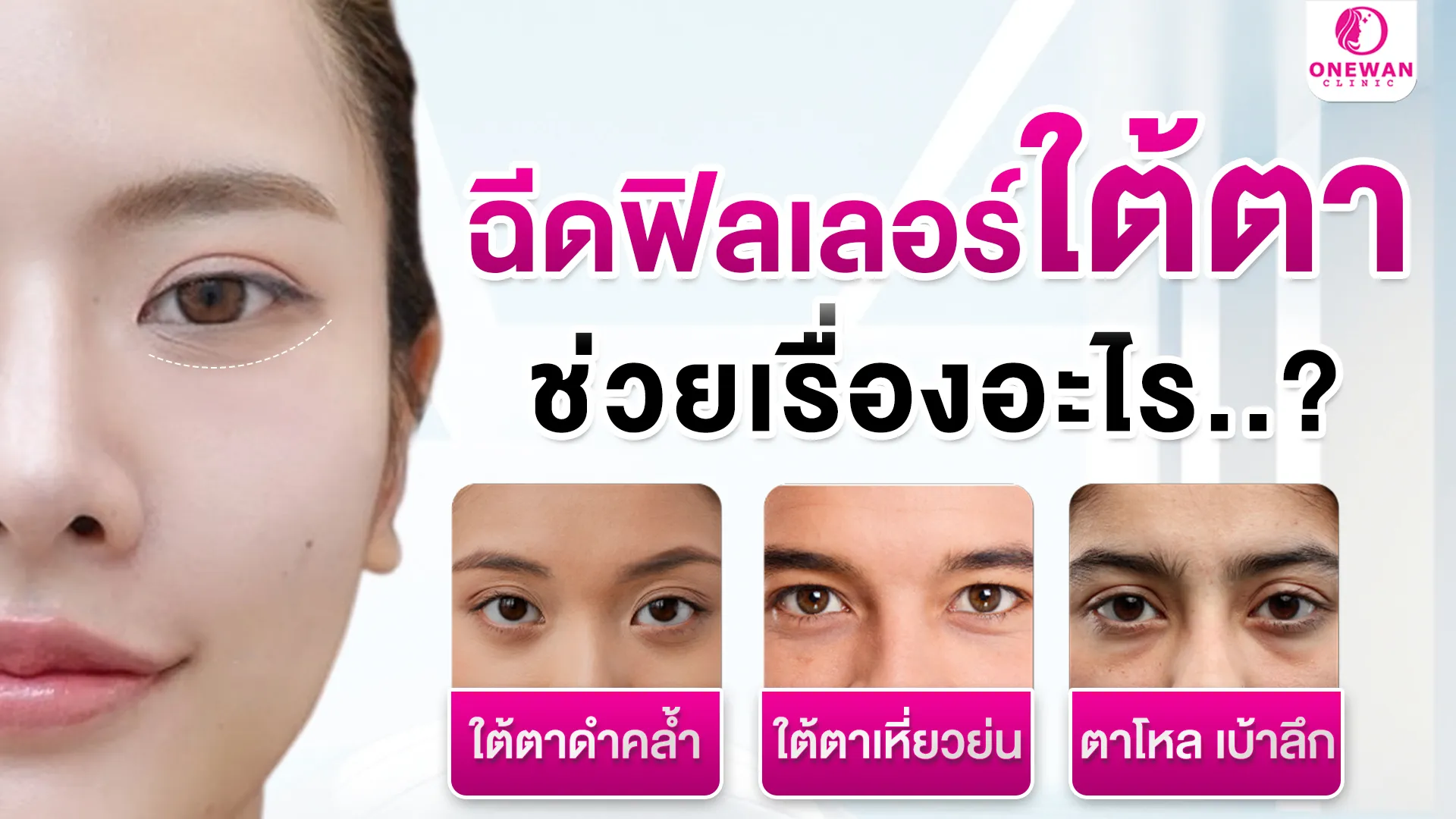 ฉีดฟิลเลอร์ใต้ตาช่วยเรื่องอะไร