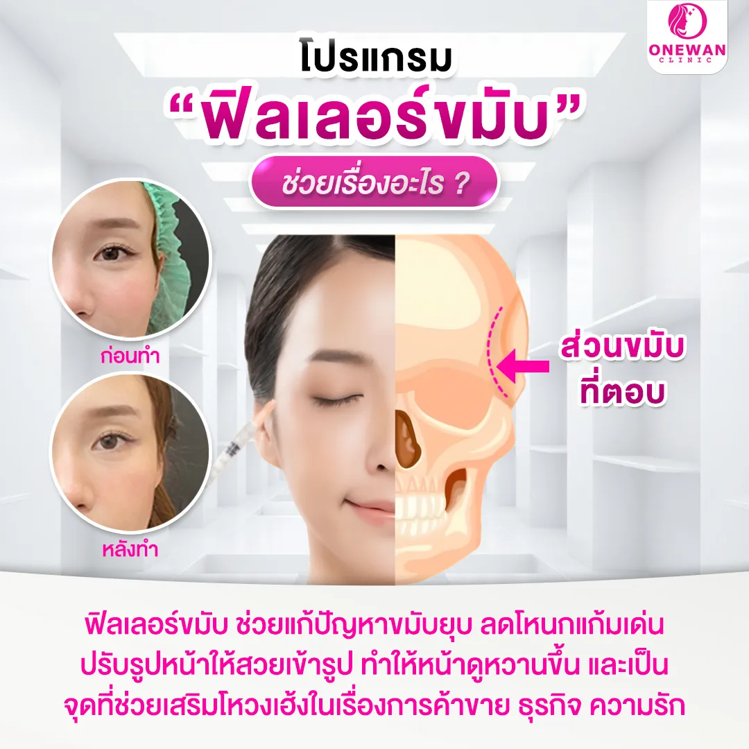 ฟิลเลอร์ขมับช่วยเรื่องอะไร