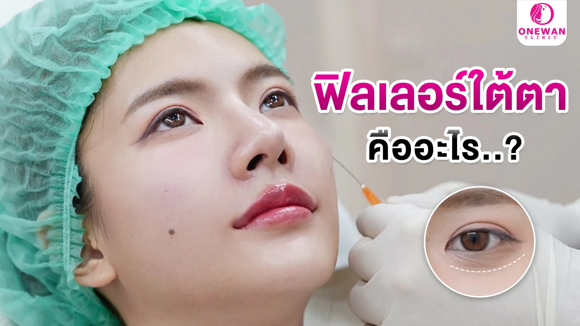 ฟิลเลอร์ใต้ตา คืออะไร