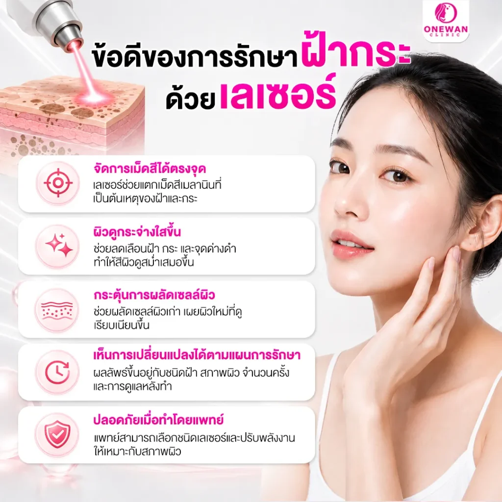 ข้อดีของการรักษาฝ้ากระด้วยเลเซอร์