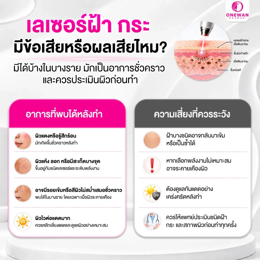 เลเซอร์ฝ้ากระ มีข้อเสียหรือผลเสียไหม