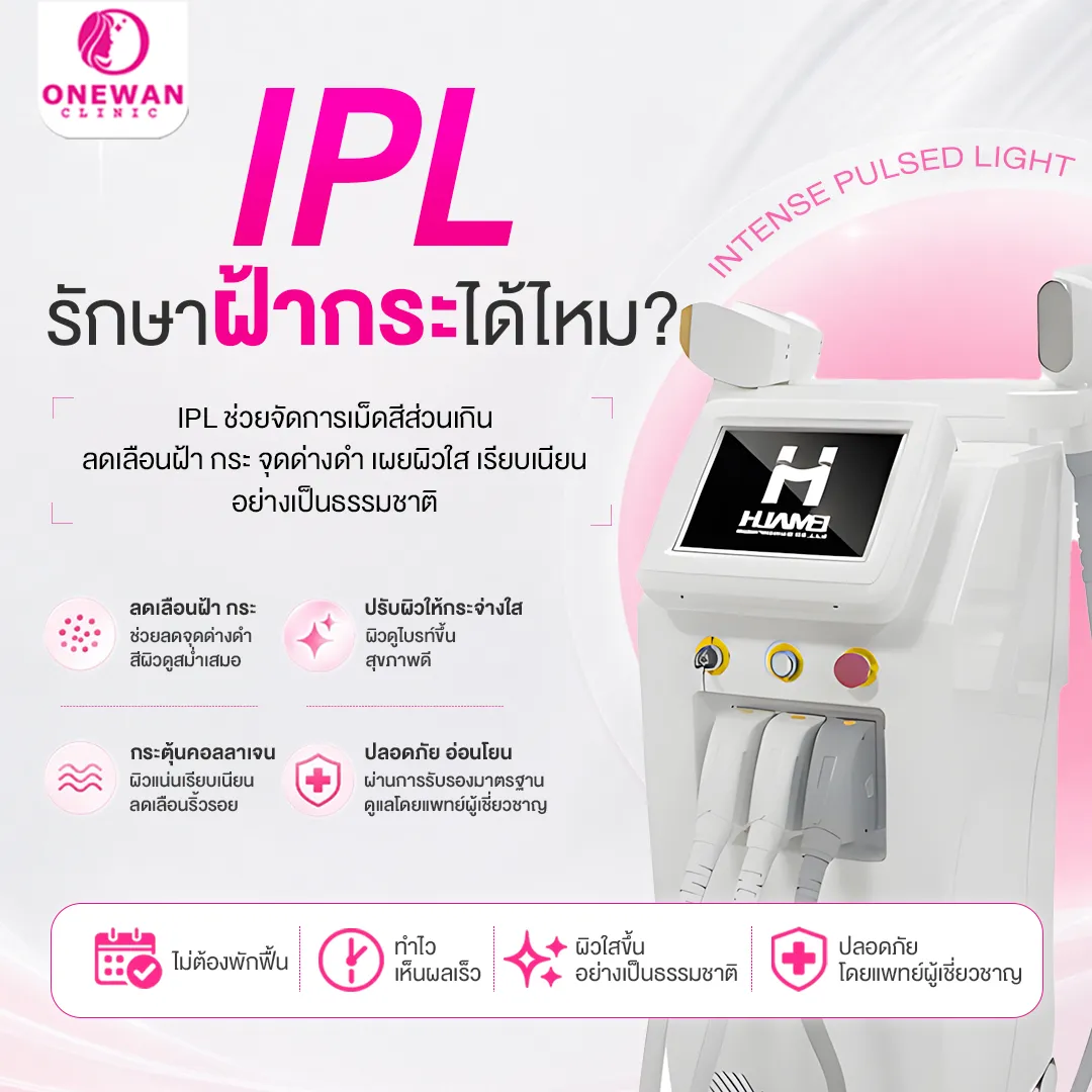 IPL รักษาฝ้ากระได้ไหม