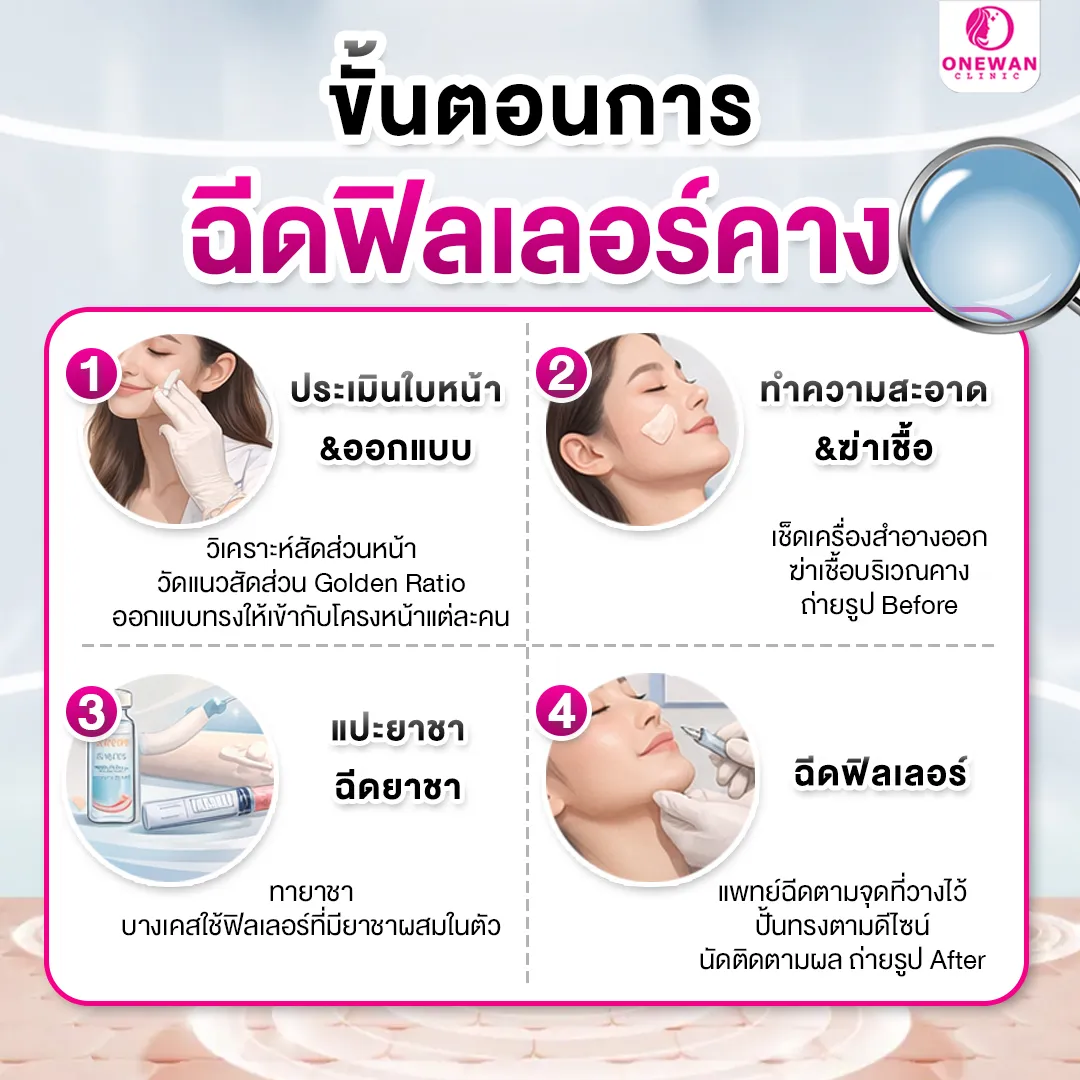 ขั้นตอนการฉีดฟิลเลอร์คาง