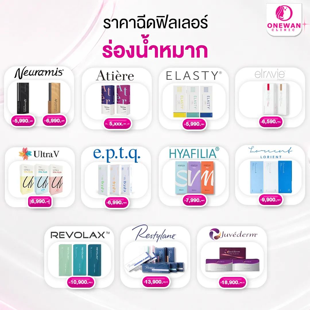 ฉีดฟิลเลอร์ร่องน้ำหมากราคาเท่าไหร่