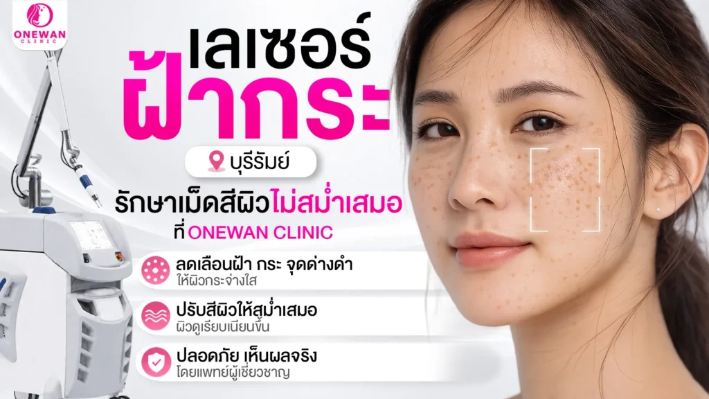 เลเซอร์ฝ้ากระ บุรีรัมย์