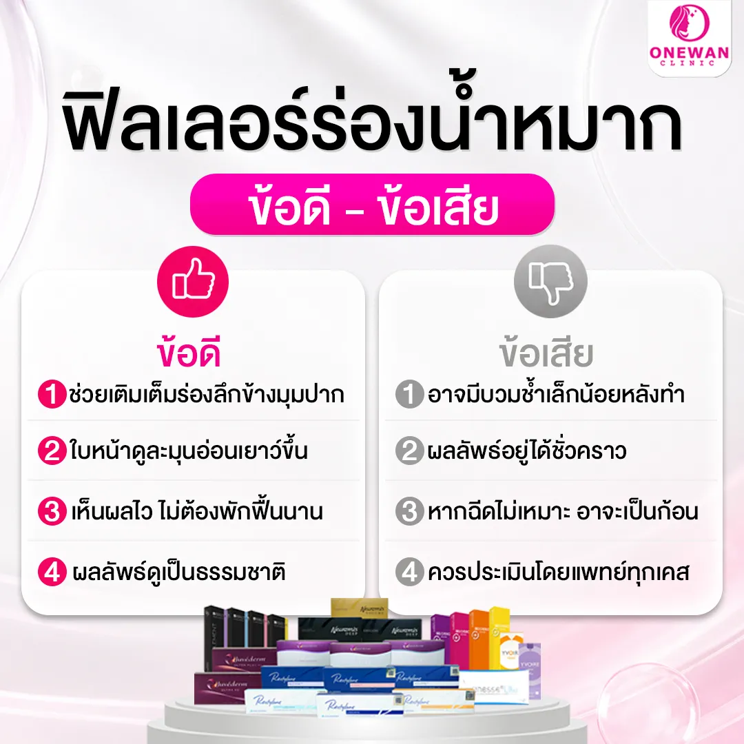 ฟิลเลอร์ร่องน้ำหมาก ข้อดี-ข้อเสีย