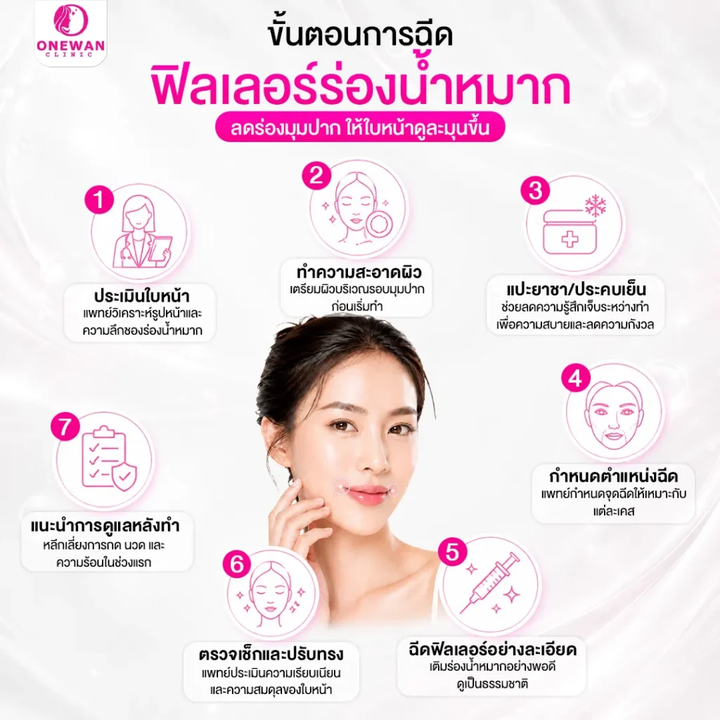ขั้นตอนการฉีดฟิลเลอร์ร่องน้ำหมาก