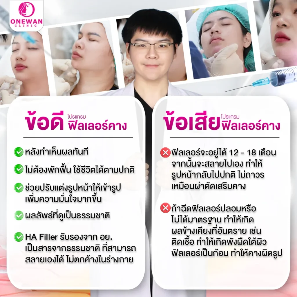 ข้อดีข้อเสียของการฉีดฟิลเลอร์คาง