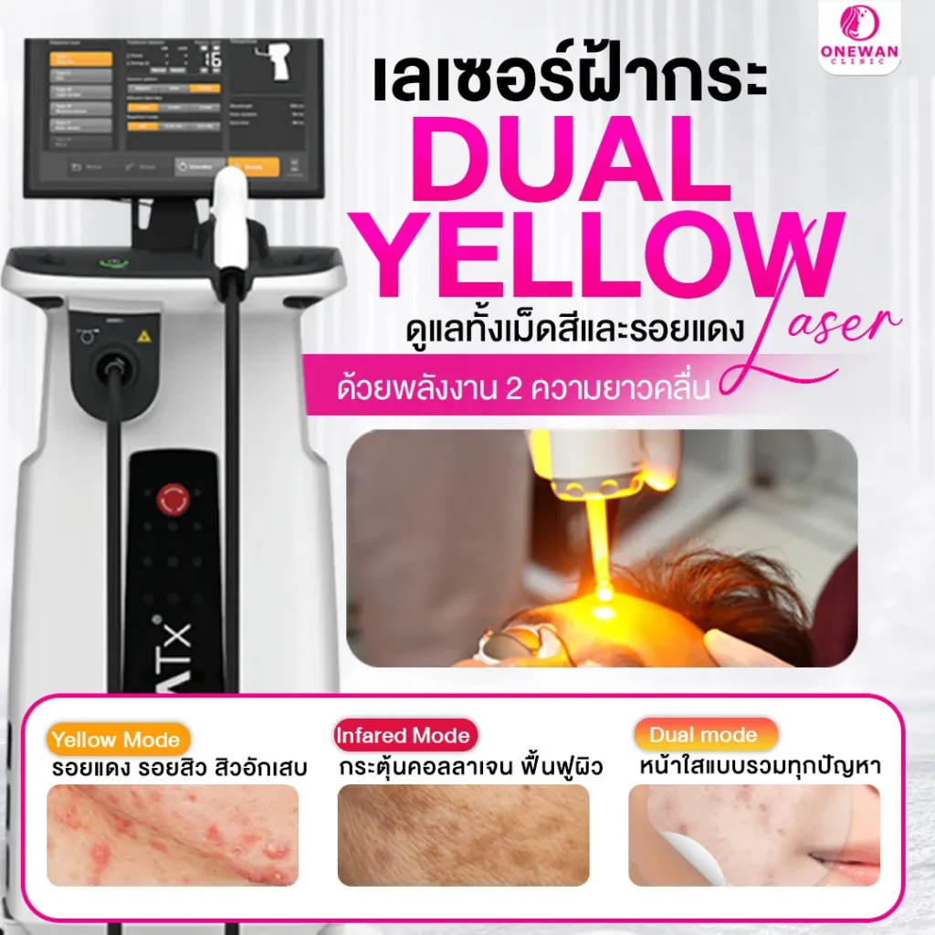 เลเซอร์ฝ้ากระด้วย Dual Yellow Laser