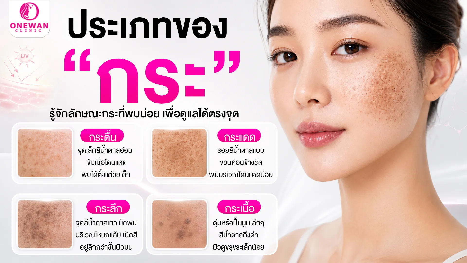 รู้จักประเภทของกระ