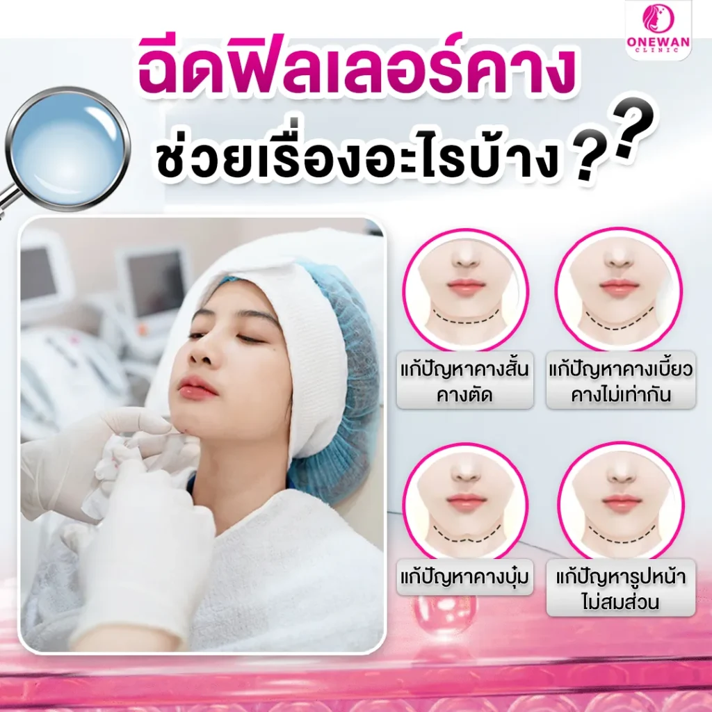 ฉีดฟิลเลอร์คาง ช่วยเรื่องอะไรบ้าง