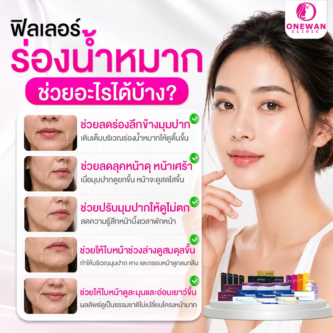 ฟิลเลอร์ร่องน้ำหมาก ช่วยอะไรได้บ้าง
