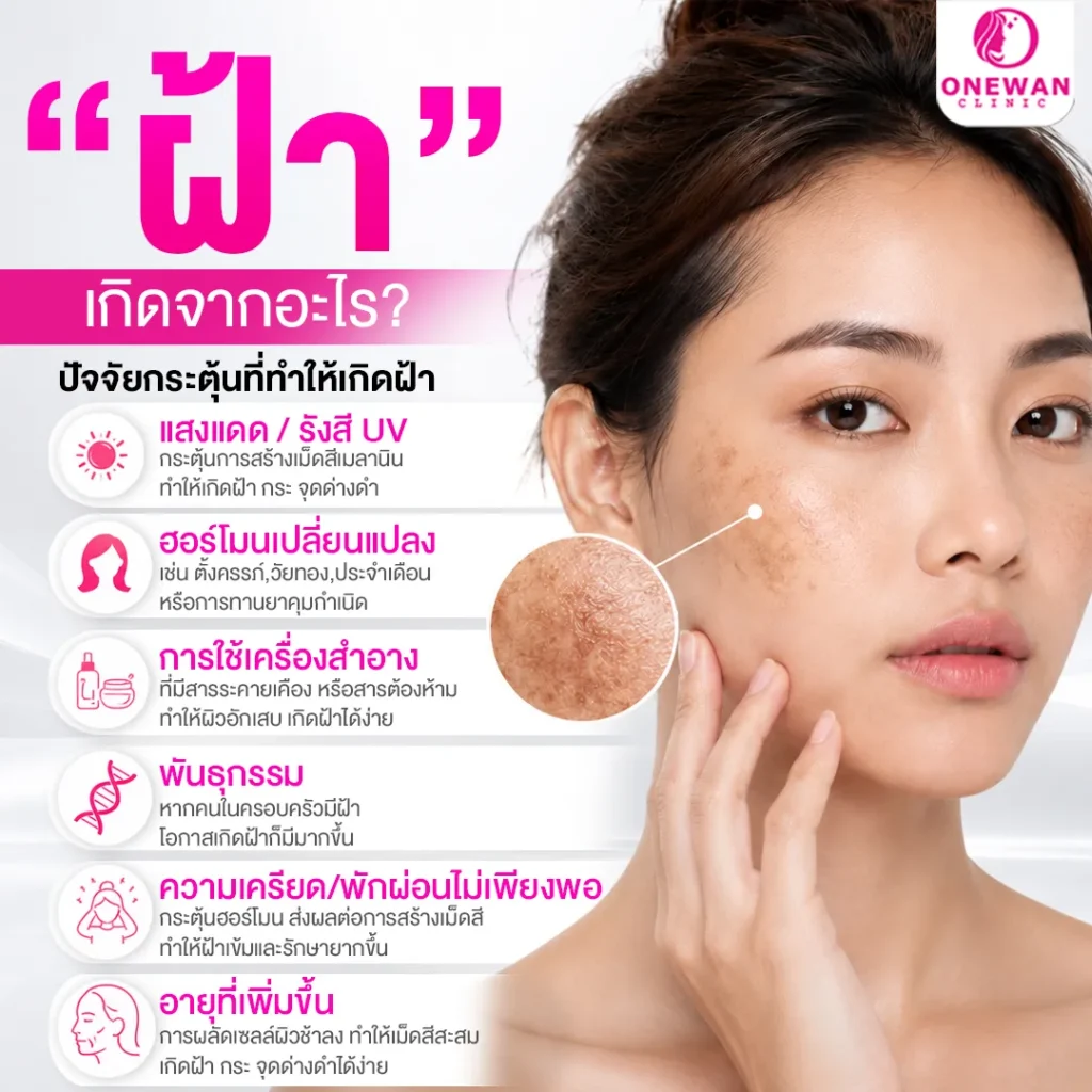 ฝ้า กระ จุดด่างดำ เกิดจากอะไร