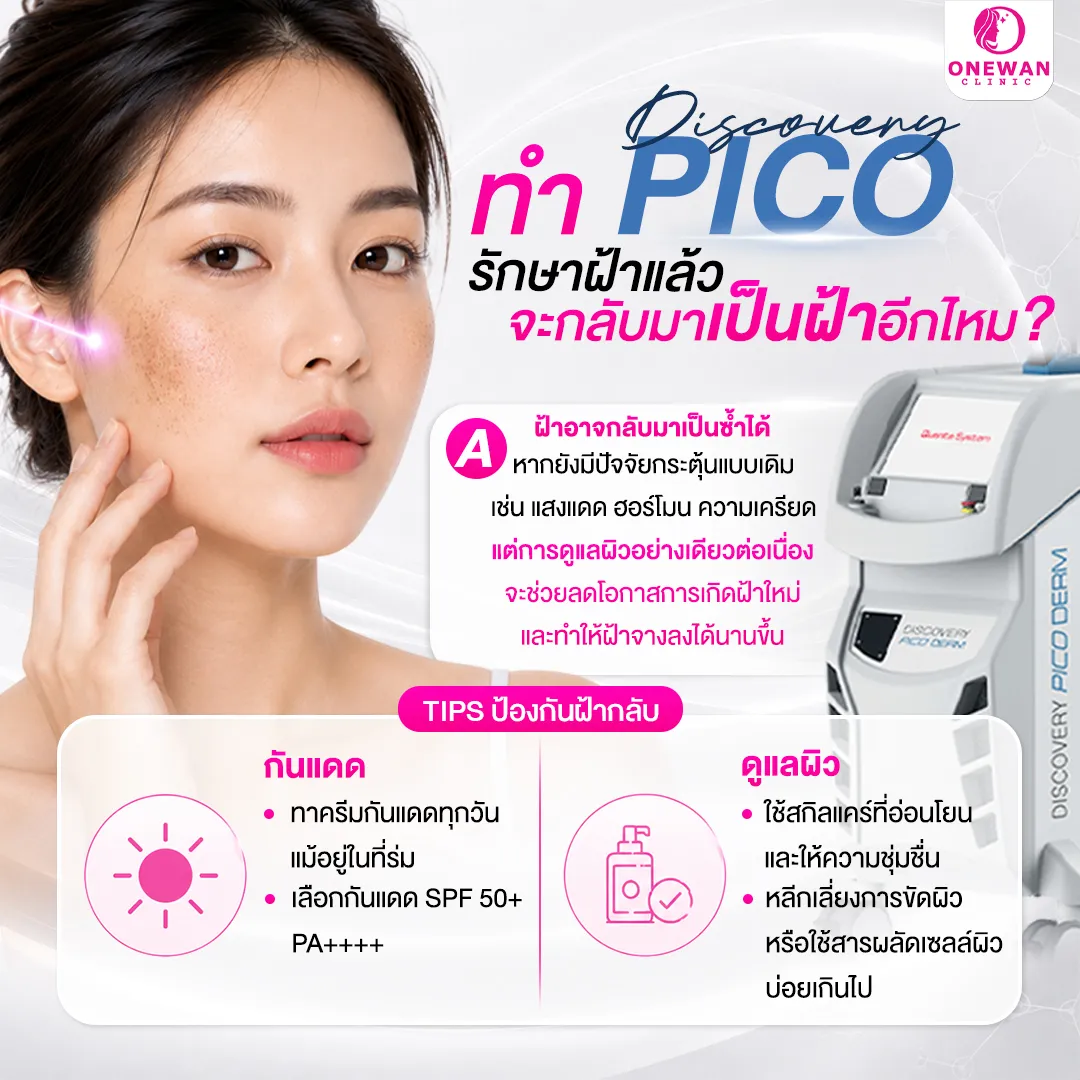 ทำ Discovery Pico รักษาฝ้าแล้ว จะกลับมาเป็นฝ้าอีกไหม