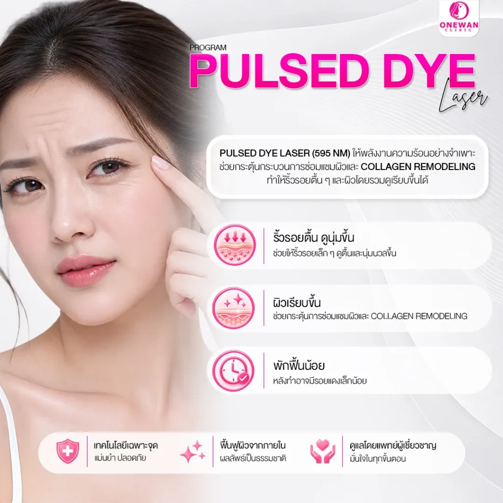 Pulse Dye Laser ลดริ้วรอยได้ไหม