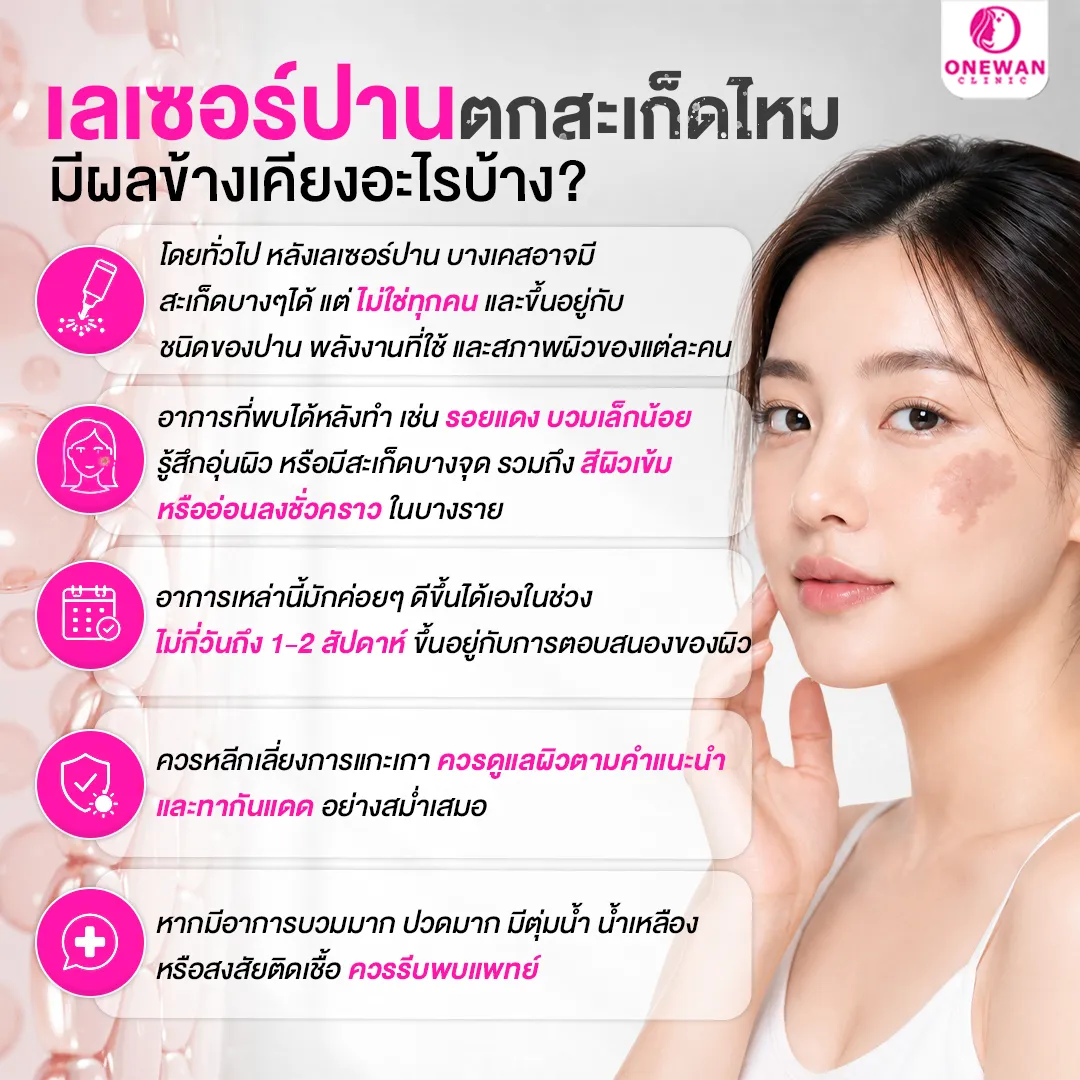 เลเซอร์ปานตกสะเก็ดไหม มีผลข้างเคียงอะไรบ้าง