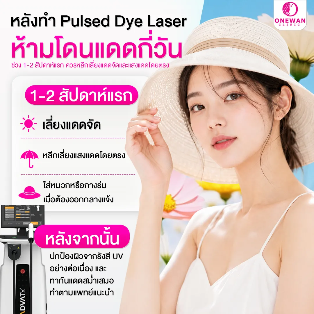 หลังทำ Pulse Dye Laser ห้ามโดนแดดกี่วัน