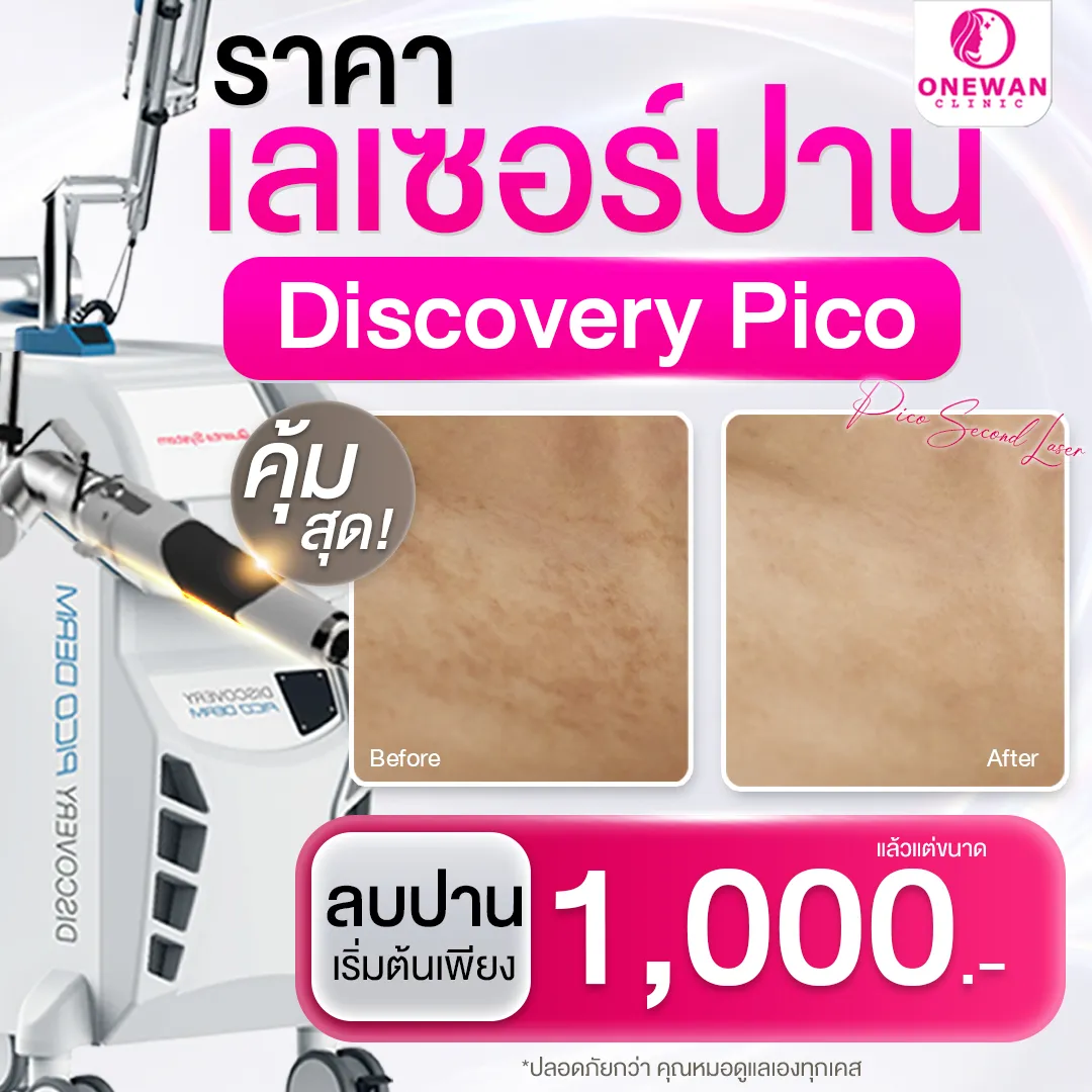 ราคาเลเซอร์ปาน บุรีรัมย์ เท่าไหร่