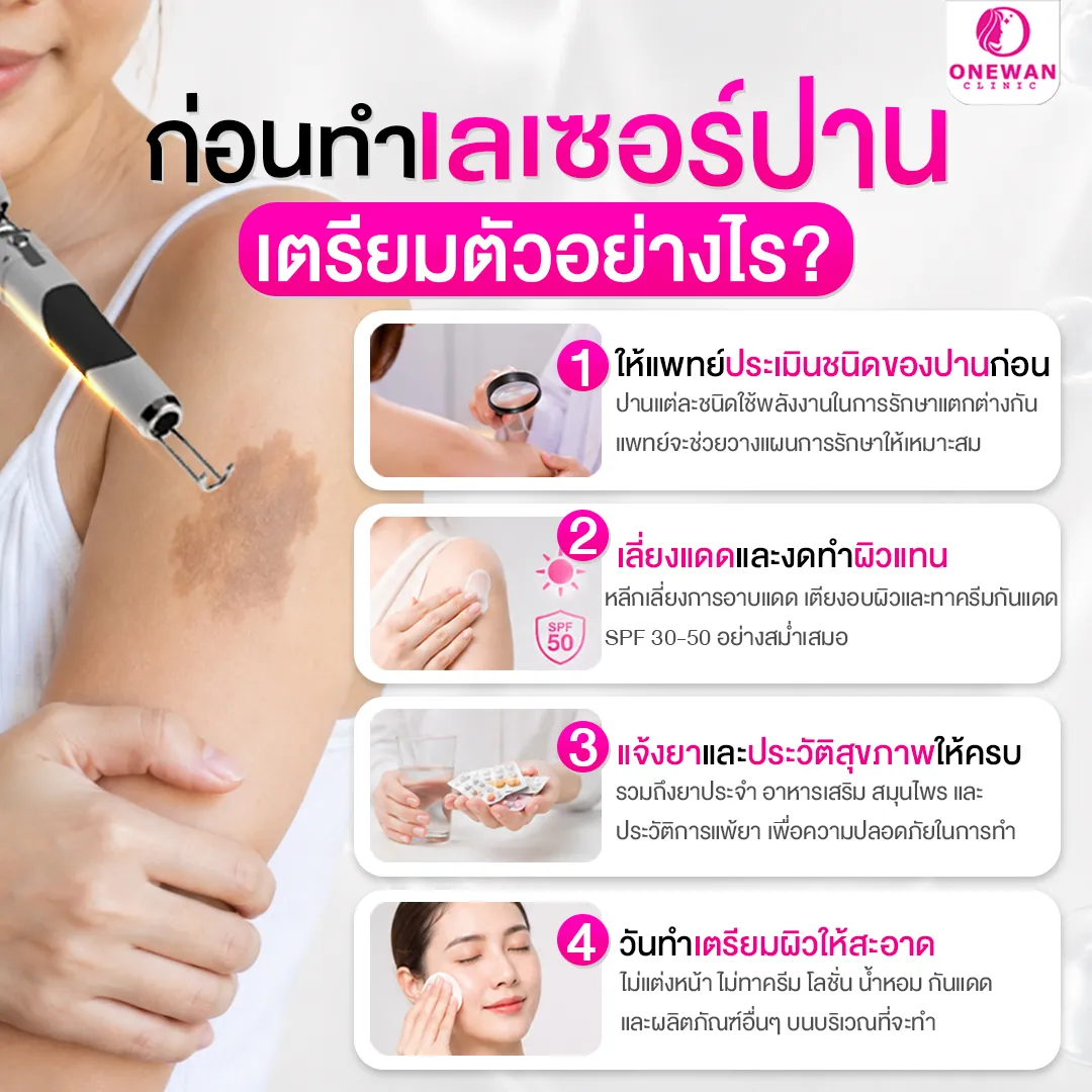 ก่อนทำเลเซอร์ปาน เตรียมตัวอย่างไร