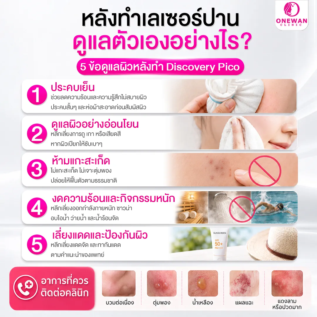 หลังทำเลเซอร์ปาน ดูแลตัวเองอย่างไร