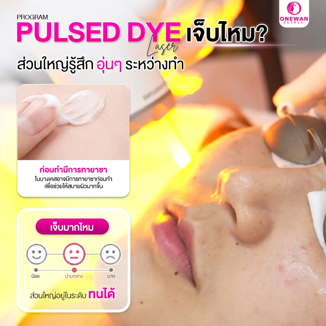 Pulse Dye Laser เจ็บไหม