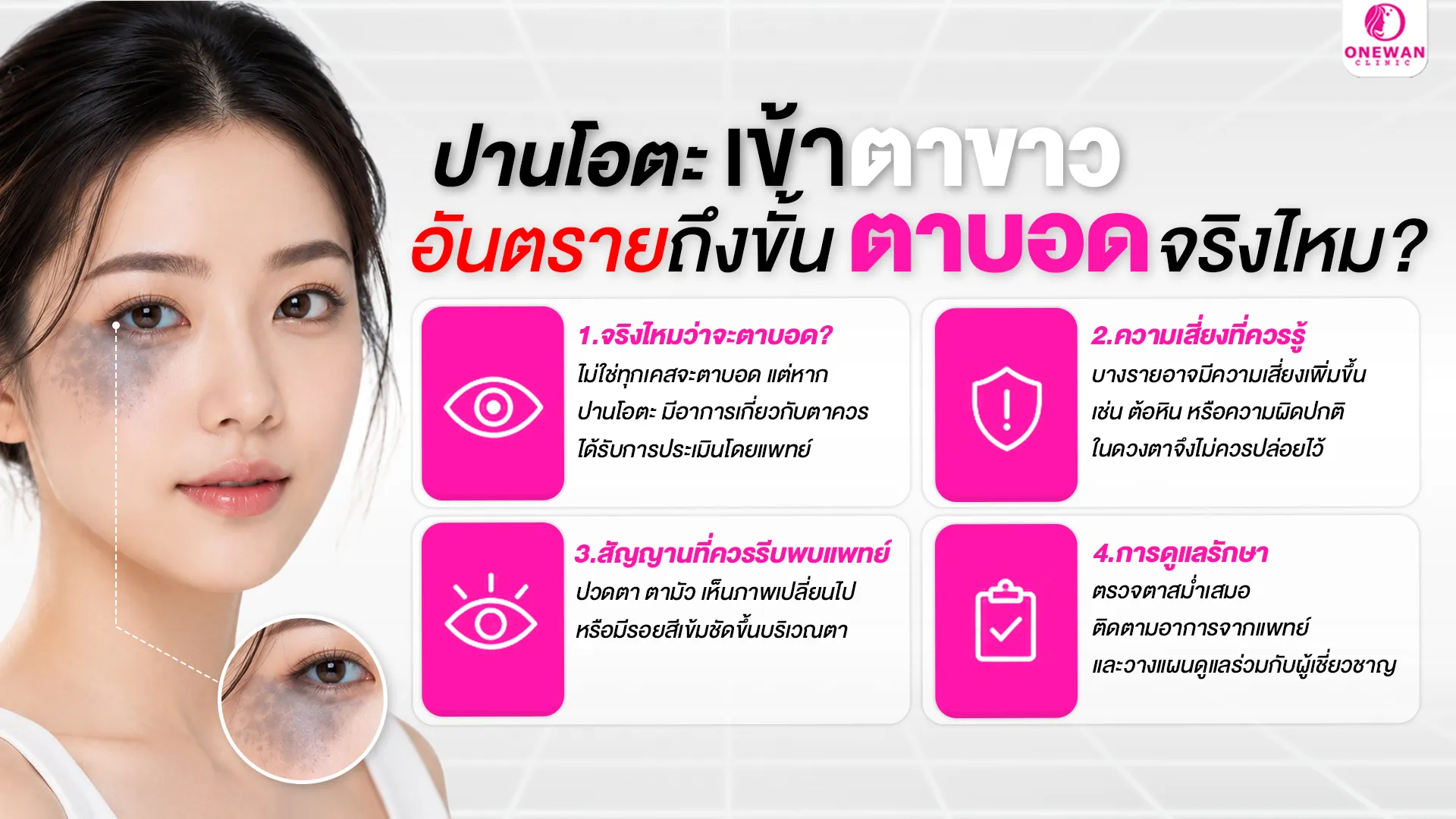 ปานโอตะเข้าตาขาว อันตรายถึงขั้นตาบอดจริงไหม