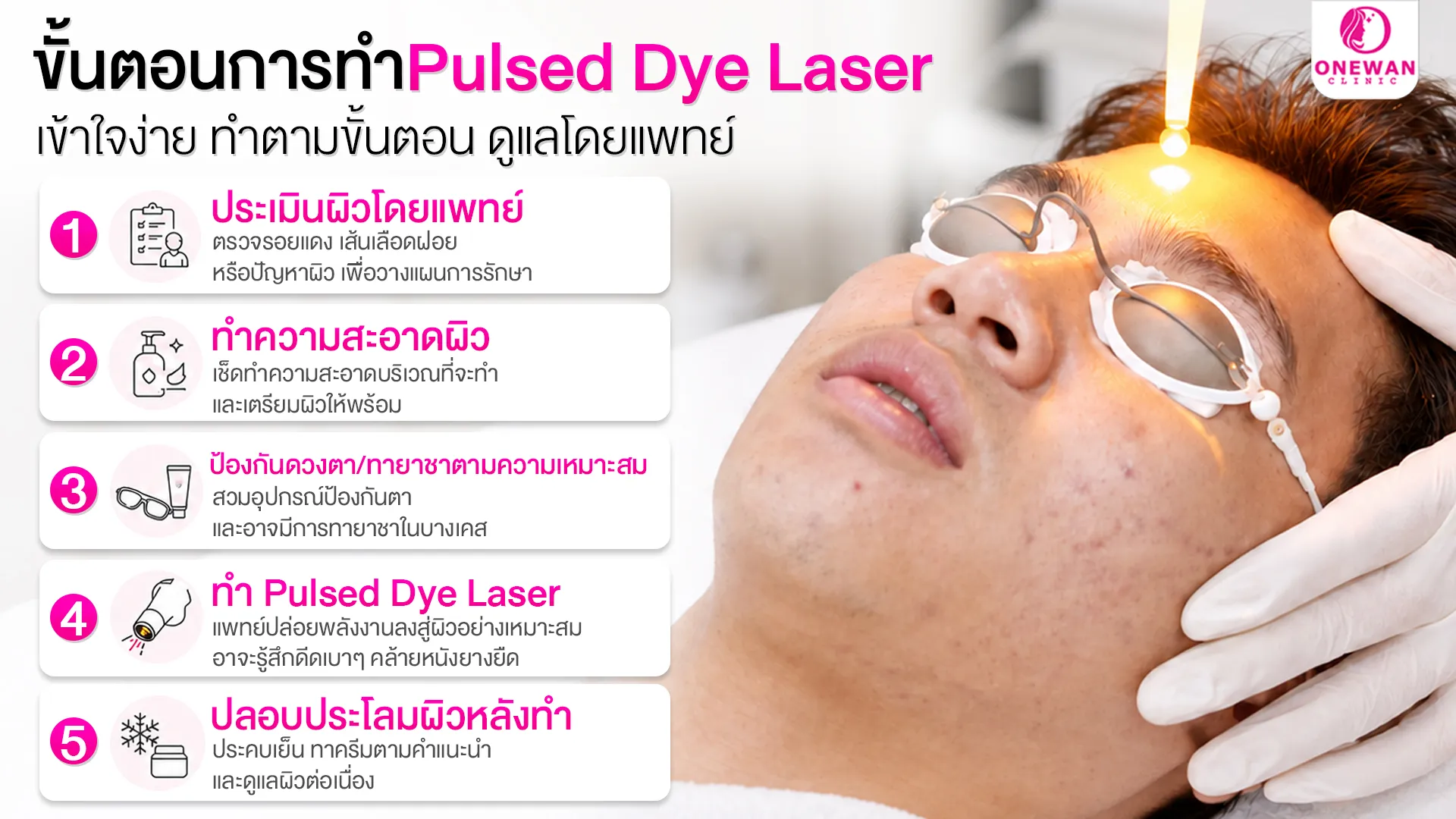 ขั้นตอนการทำ Pulse Dye Laser