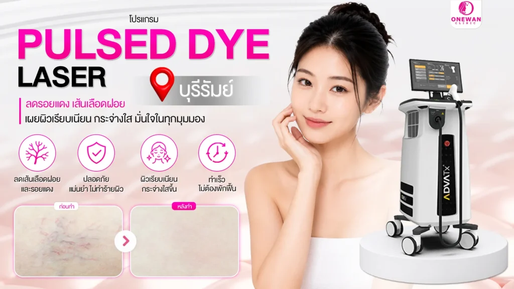 Pulse Dye Laser บุรีรัมย์