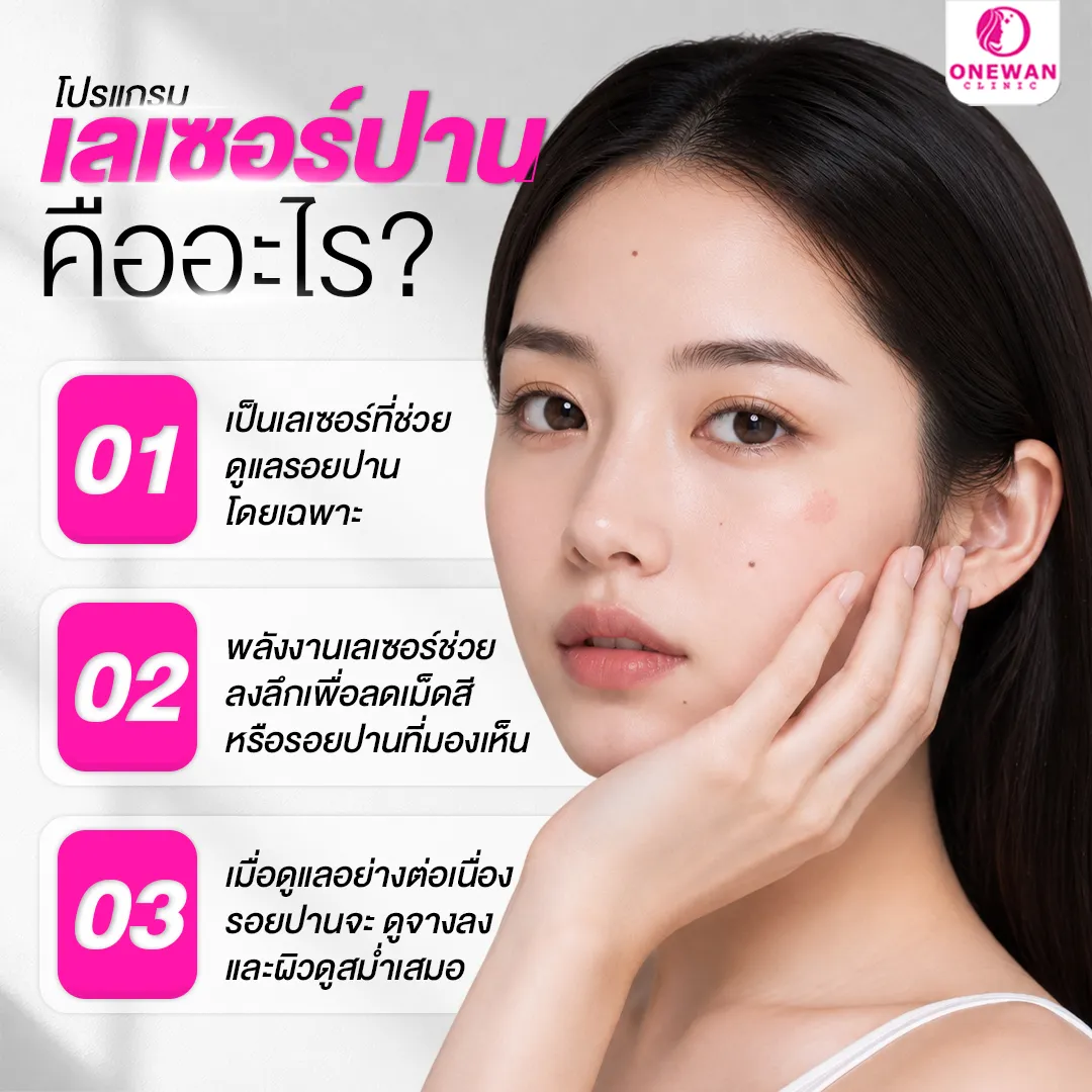เลเซอร์ปาน คืออะไร