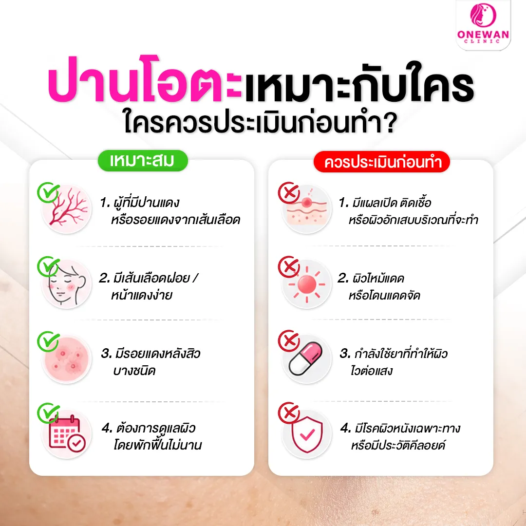 เลเซอร์ปานเหมาะกับใคร ใครไม่ควรทำ