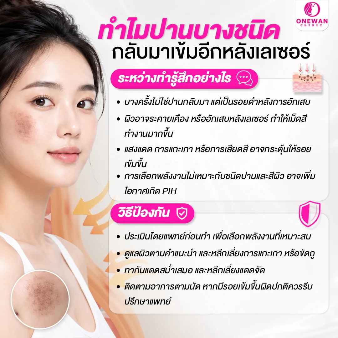 ทำไมปานบางชนิดกลับมาเข้มอีกหลังเลเซอร์