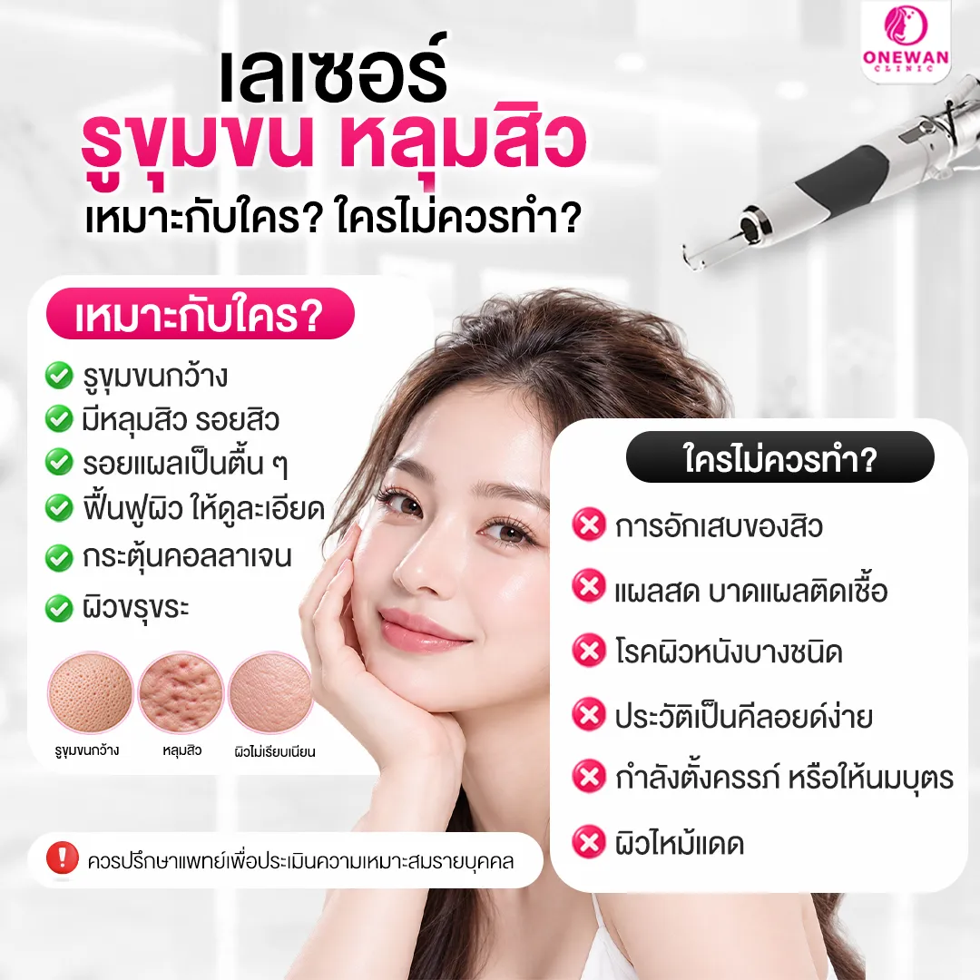 เลเซอร์รูขุมขนหลุมสิวเหมาะกับใคร ใครไม่ควรทำ